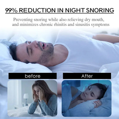 Dolano™ SleepPatch – Stop snurken & adem beter tijdens de nacht